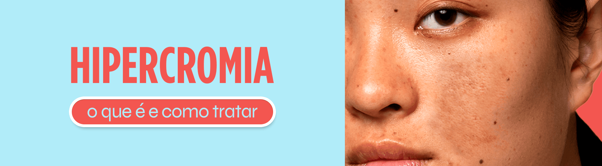 Hipercromia: O que é e como tratar